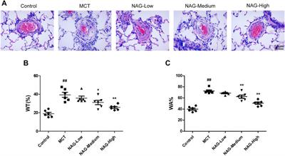 Naringin Ameliorates Monocrotaline-Induced Pulmonary Arterial Hypertension Through <mark class="highlighted">Endothelial-To-Mesenchymal Transition</mark> Inhibition